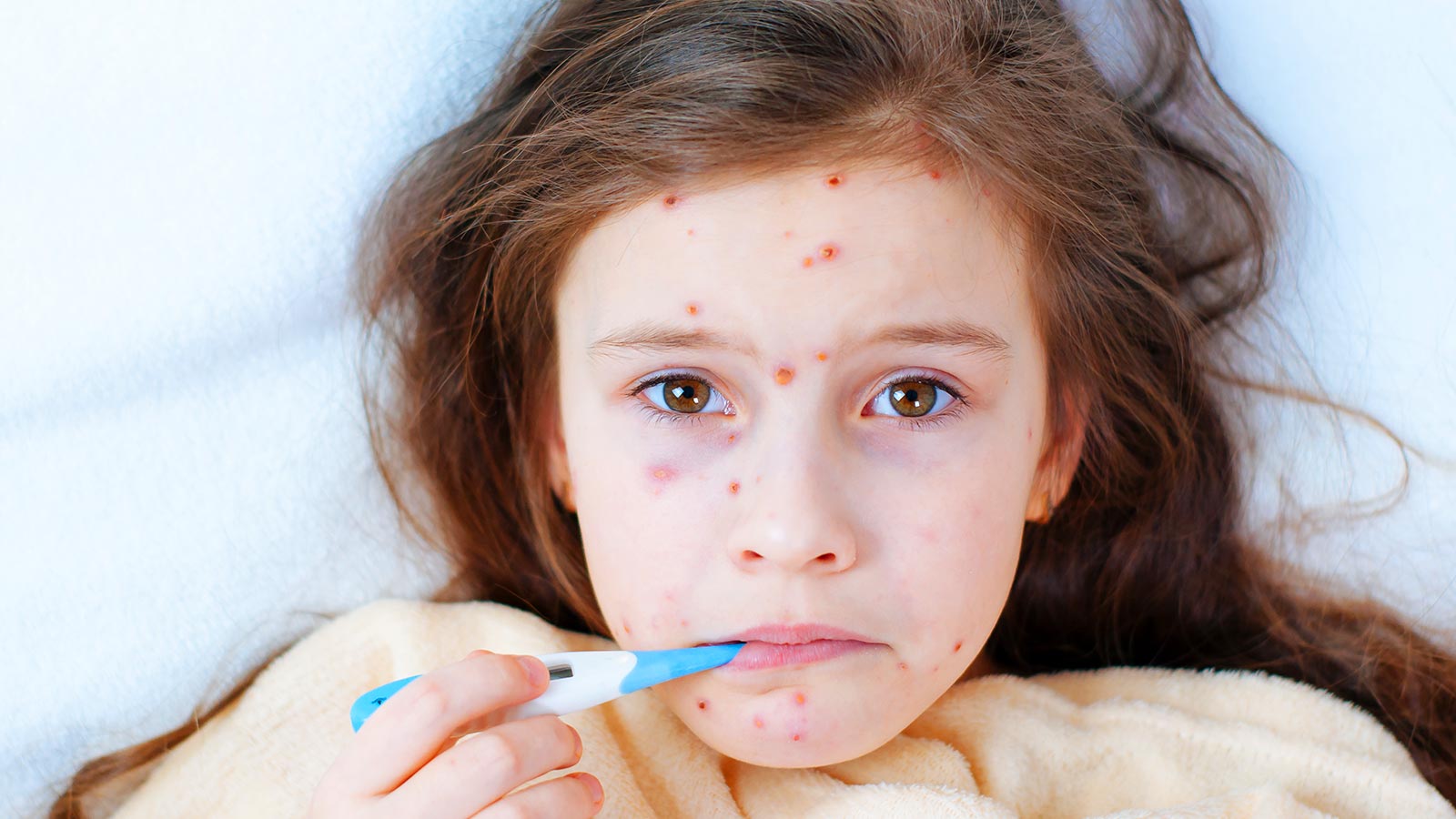 Polémica vacunación